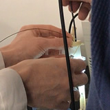 Intubación a través de Dispositivo Supraglótico